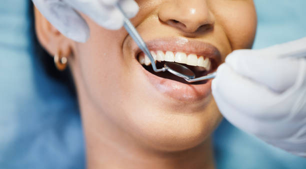 Best After-Hours Emergency Dentist in Cottonwood Shores, TX
